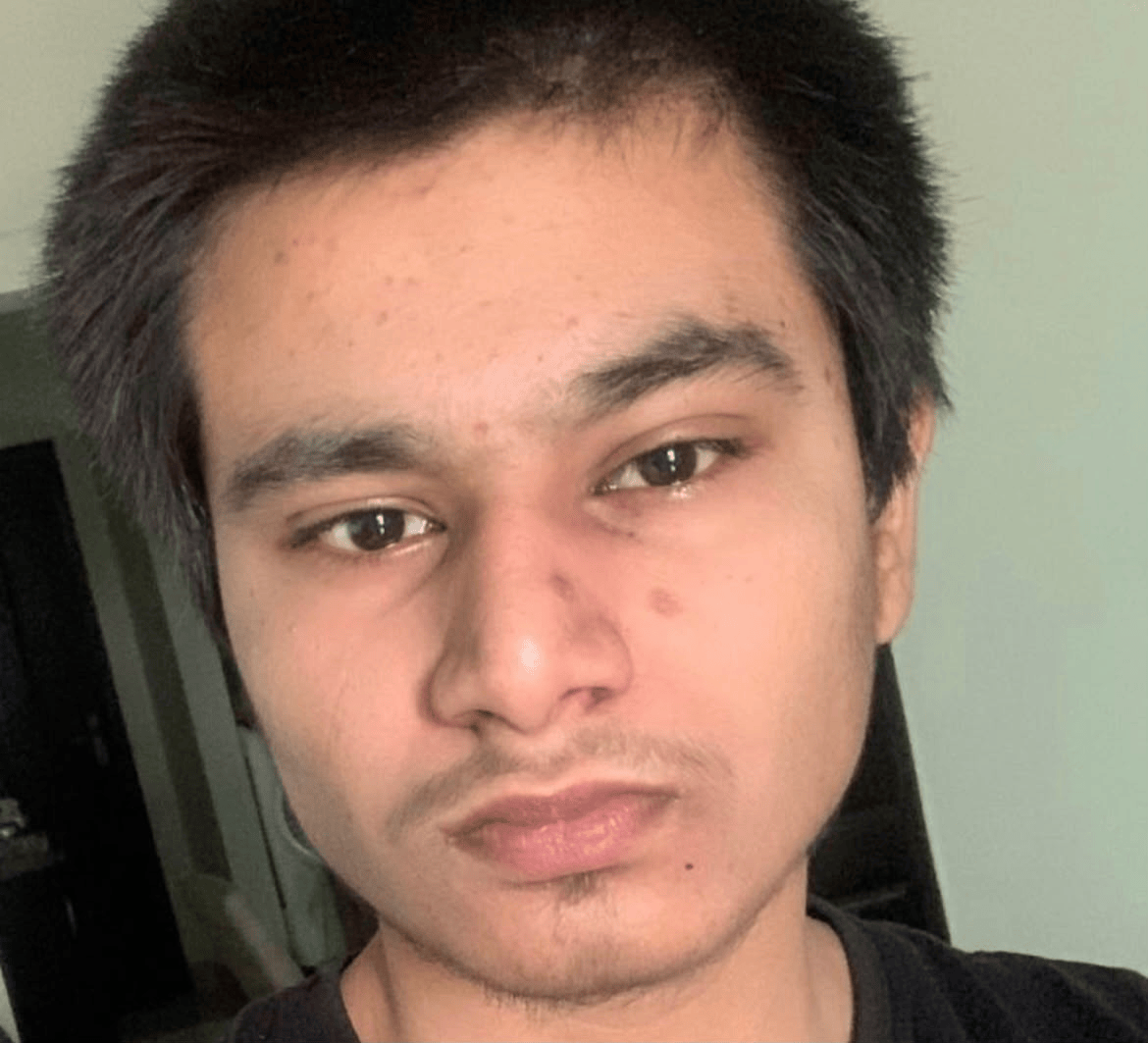Dex before applying the SBI-V Method